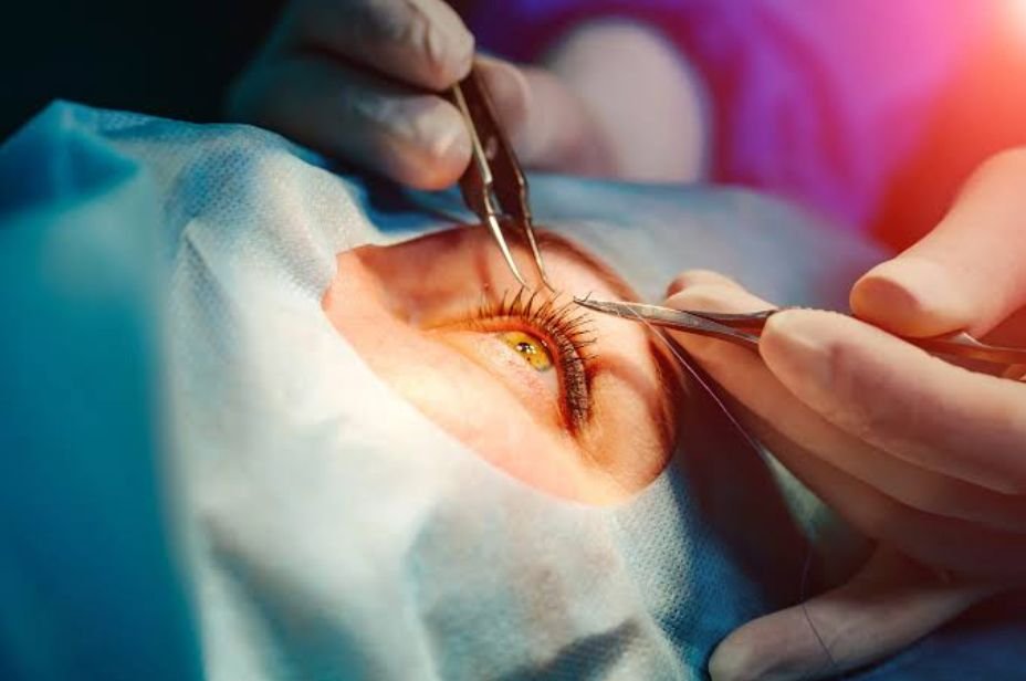 Sutures